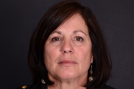 Facelift and Laser Skin Resurfacing Patient 10